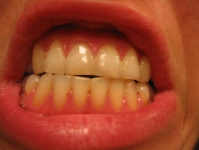 teeth